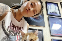 好声音选手毕夏车祸阴影下，半年内两次开颅手术，坚强面对生活挑战