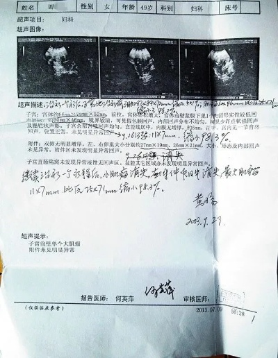 院方通报惊人案例，男性确诊子宫肌瘤引发社会关注与医学探讨
